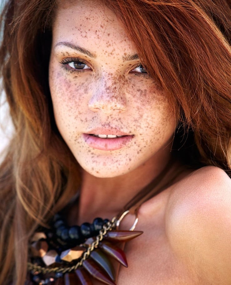 Red hair freckles facial