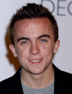 Picture of Frankie Muniz