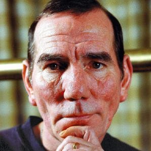 Pete Postlethwaite