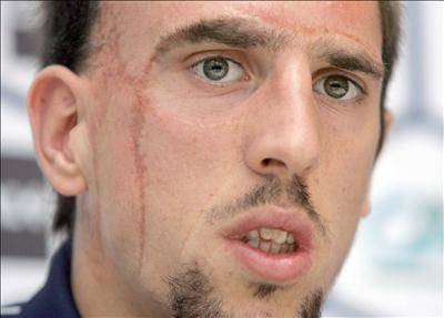 Franck Ribéry