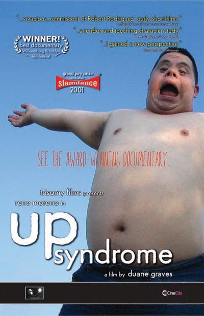 Up Syndrome