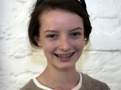 Skins Skins