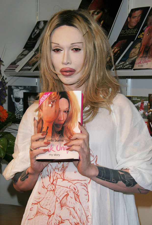 Pete Burns