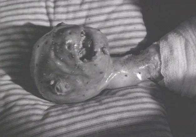Eraserhead Eraserhead