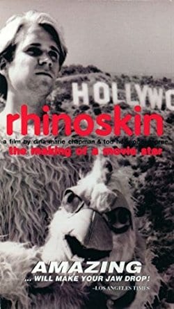 Rhinoskin: The Making of a Movie Star