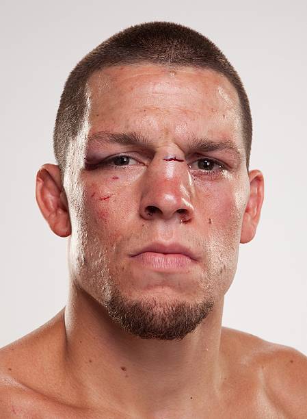 Nate Diaz