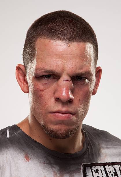 Nate Diaz