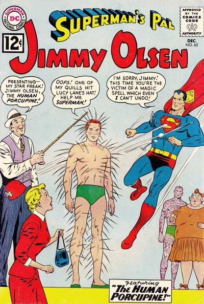 Superman's Pal, Jimmy Olsen Superman's Pal, Jimmy Olsen