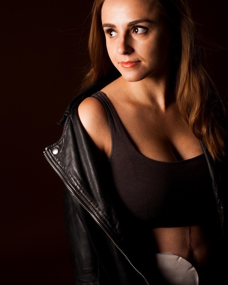 Hannah Witton