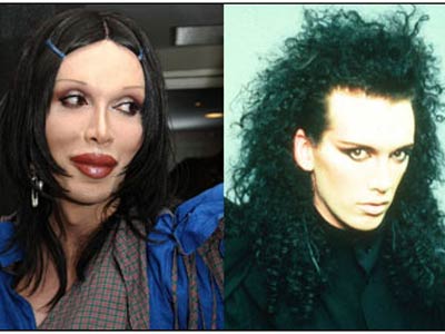 Pete Burns