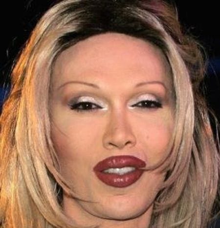 Pete Burns