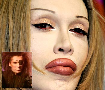 Pete Burns