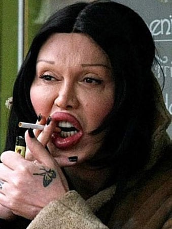 Pete Burns