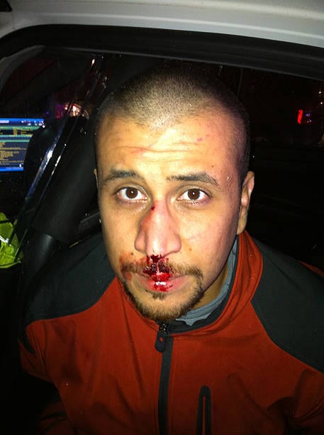 George Zimmerman