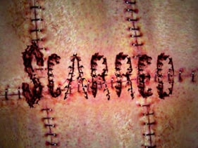 Scarred