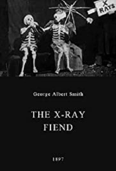 The X-Rays