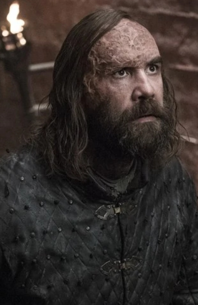 Sandor Clegane (The Hound)