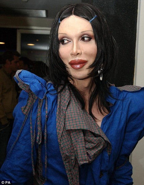 Pete Burns