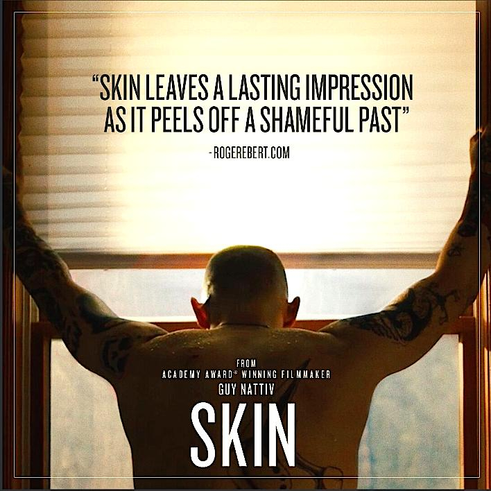 Skin