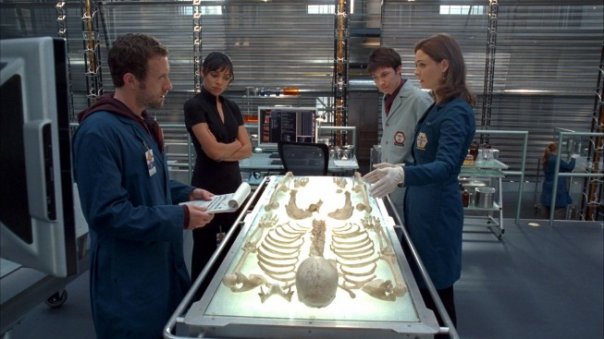 Bones