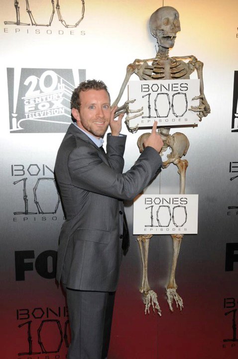 Bones