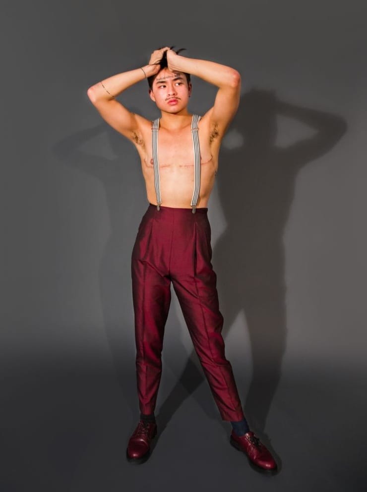 Chella Man