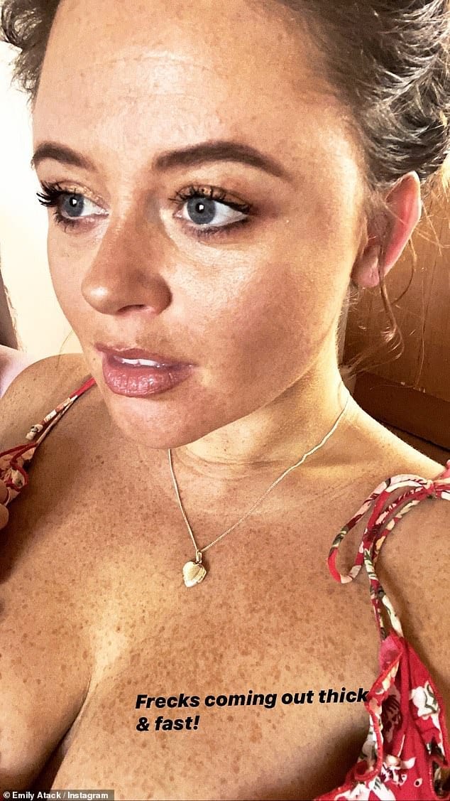 Emily Atack