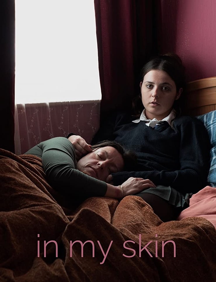 Picture of In My Skin