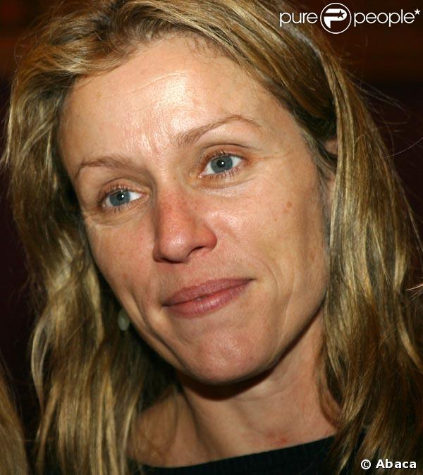 Frances McDormand