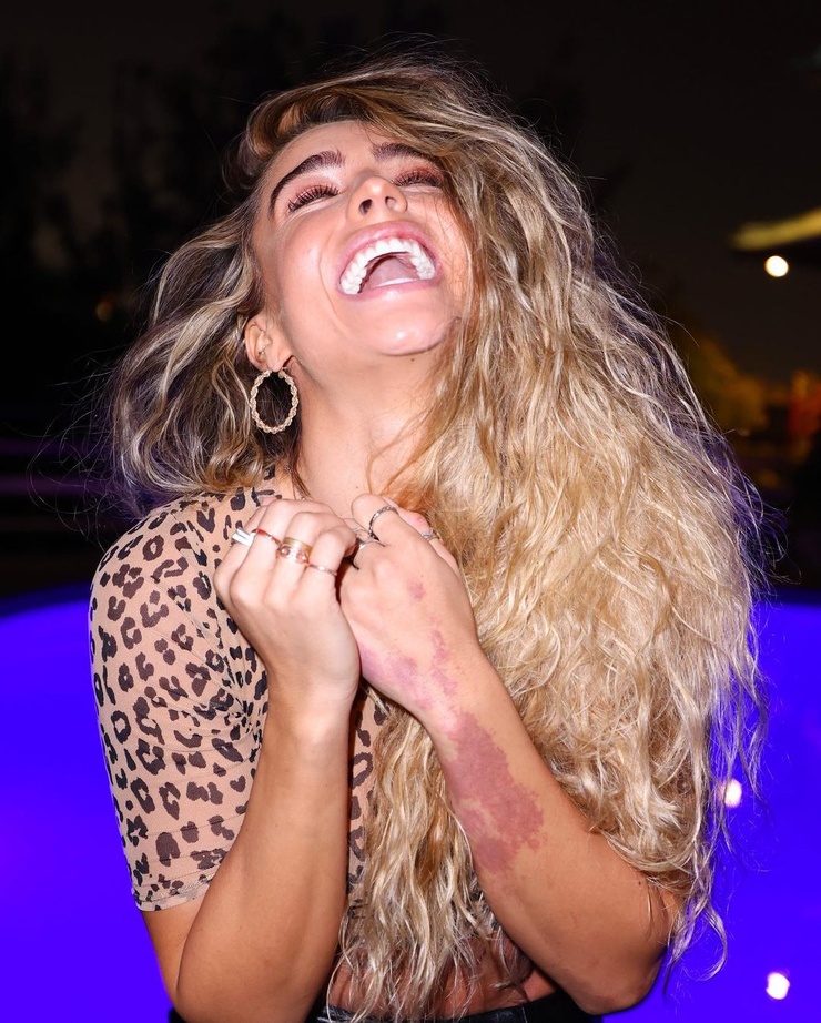 Sommer Ray