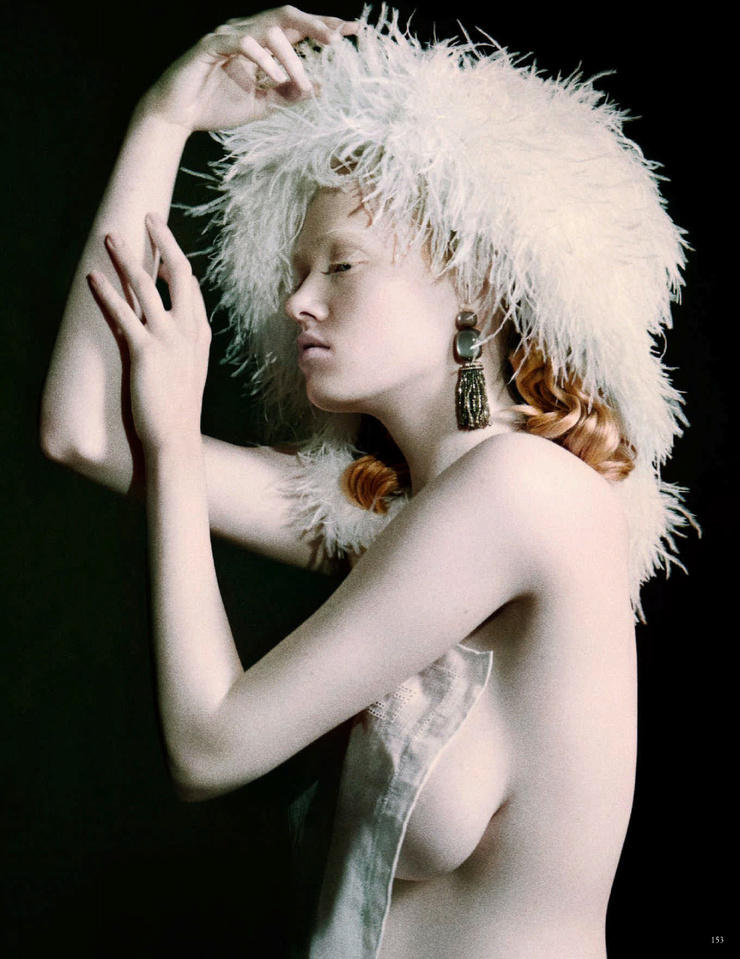 Betsy Teske