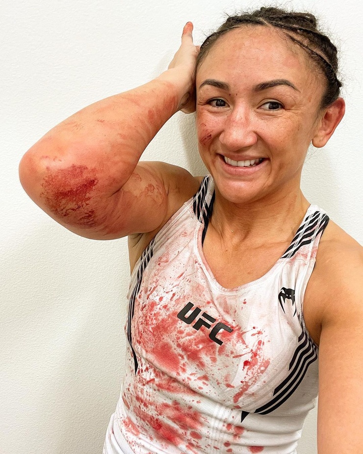 Carla Esparza