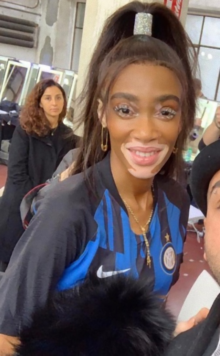 Winnie Harlow