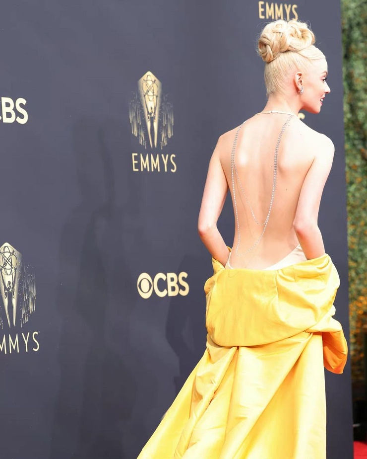 Anya Taylor-Joy Anya Taylor-Joy