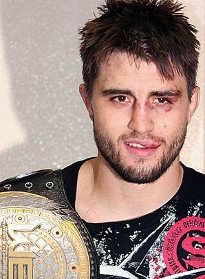 Carlos Condit