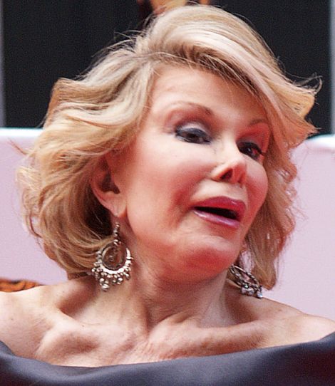 Joan Rivers Joan Rivers