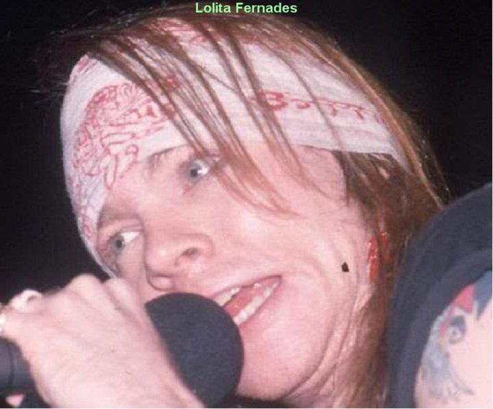Axl Rose