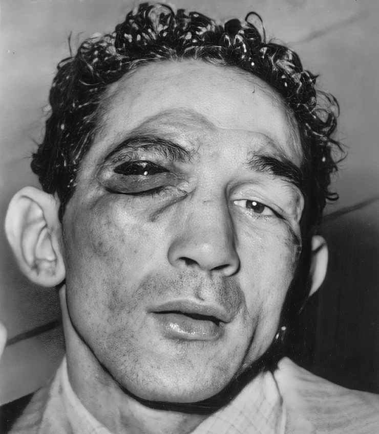 Willie Pep