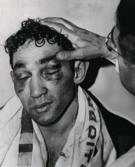 Willie Pep