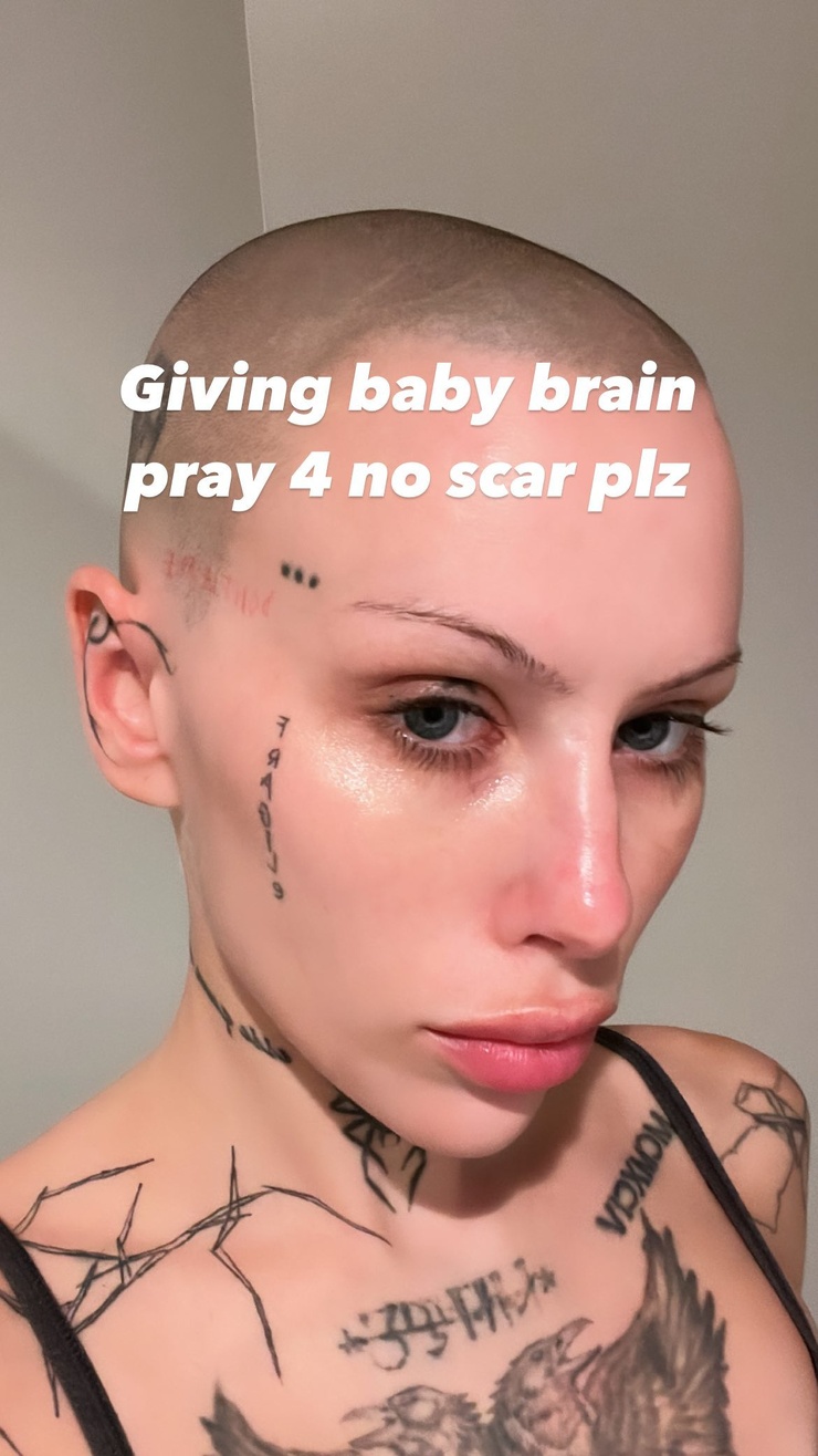 Siiickbrain