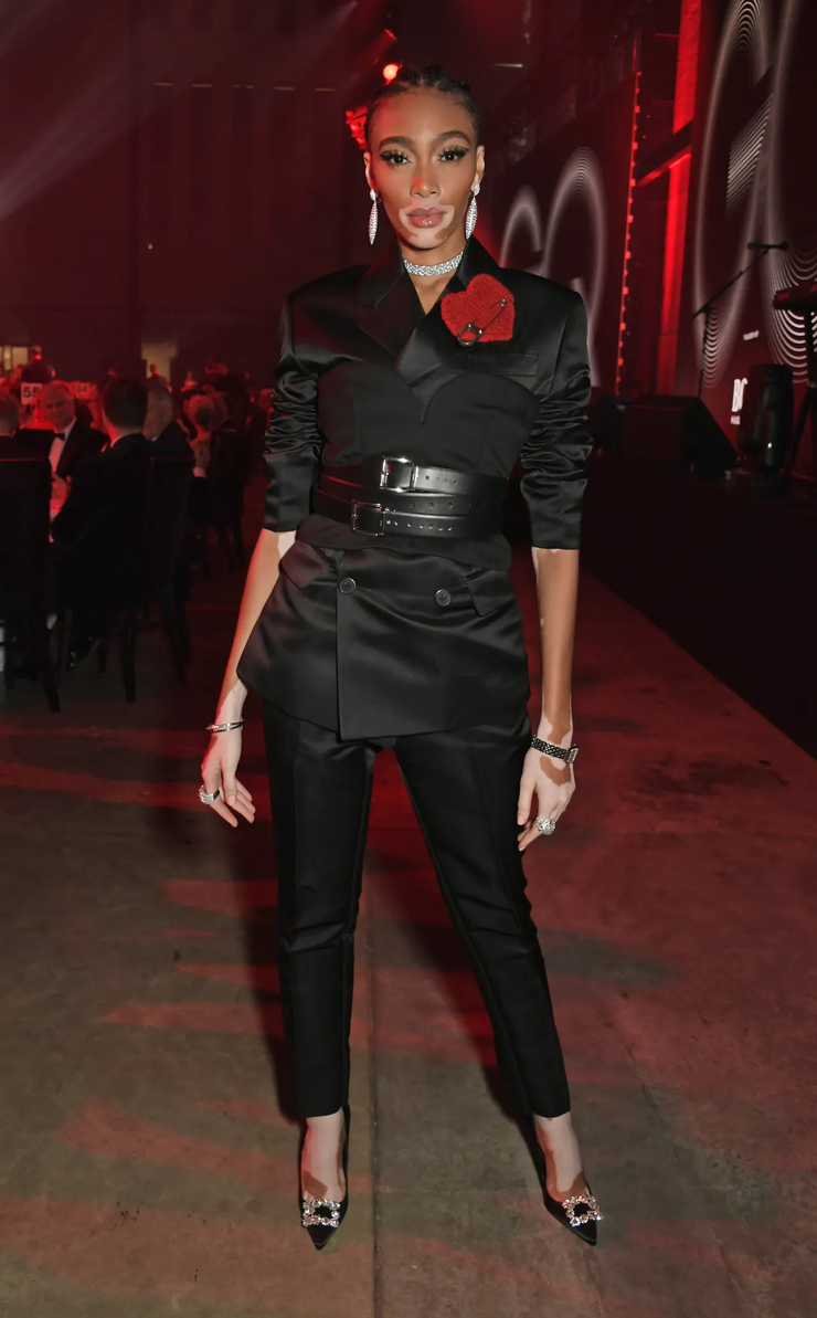 Winnie Harlow