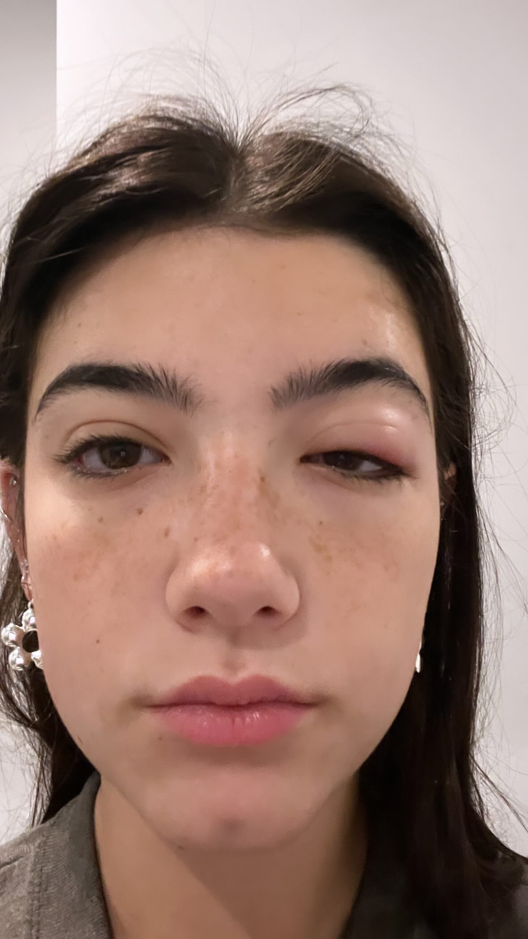 Charli D'Amelio picture