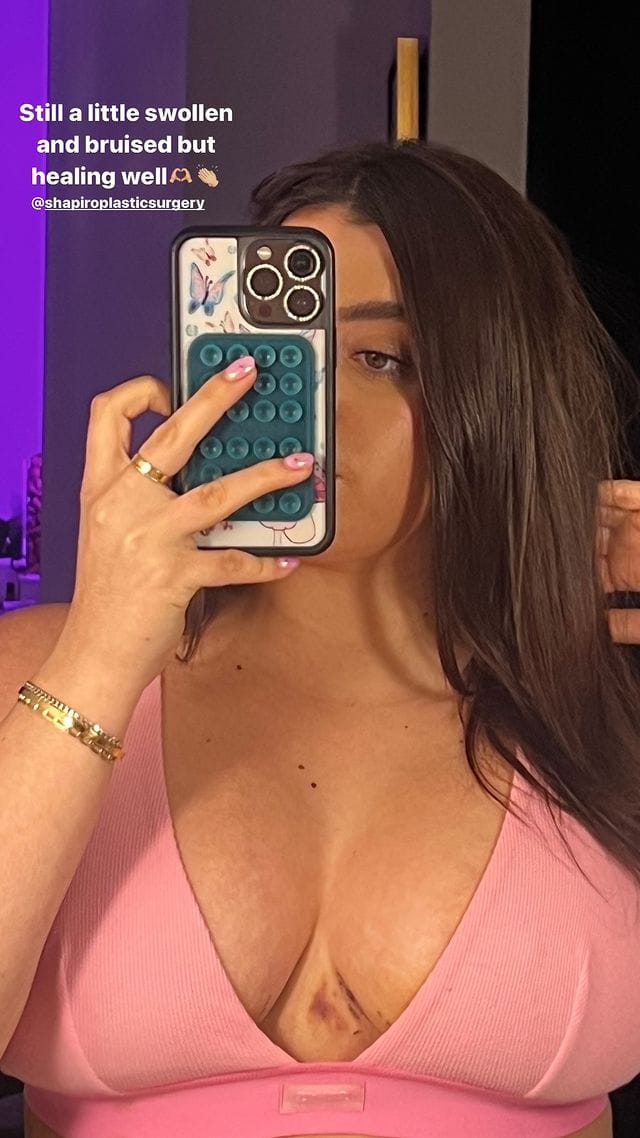 Kalani Hilliker