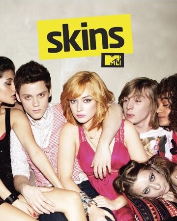 Skins (US)
