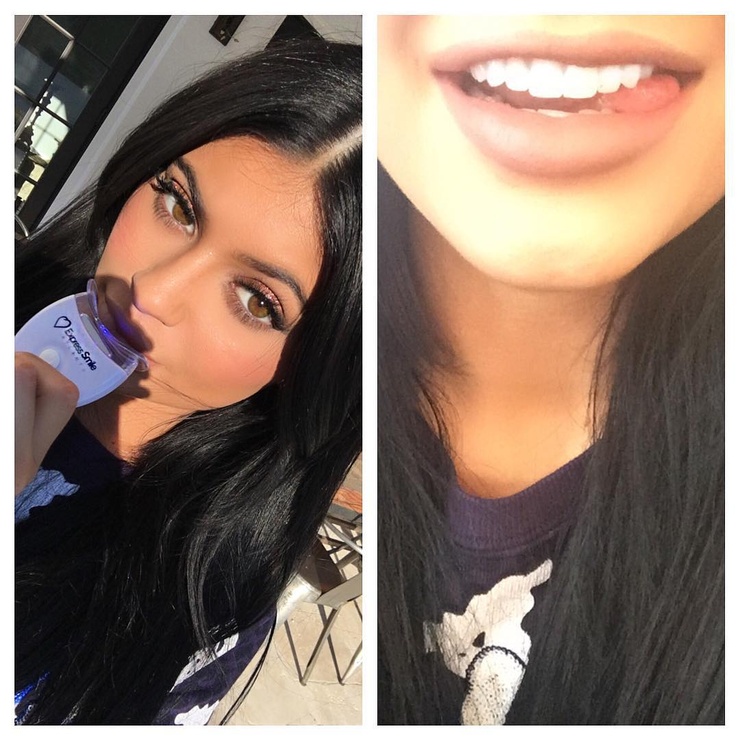 Kylie Jenner