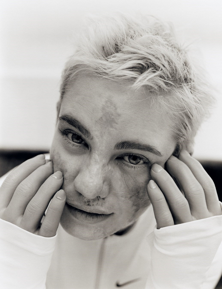 Beatrice Vio
