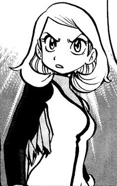 Y (Pokémon Adventures)