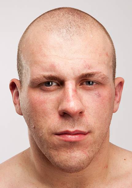 Rob Broughton