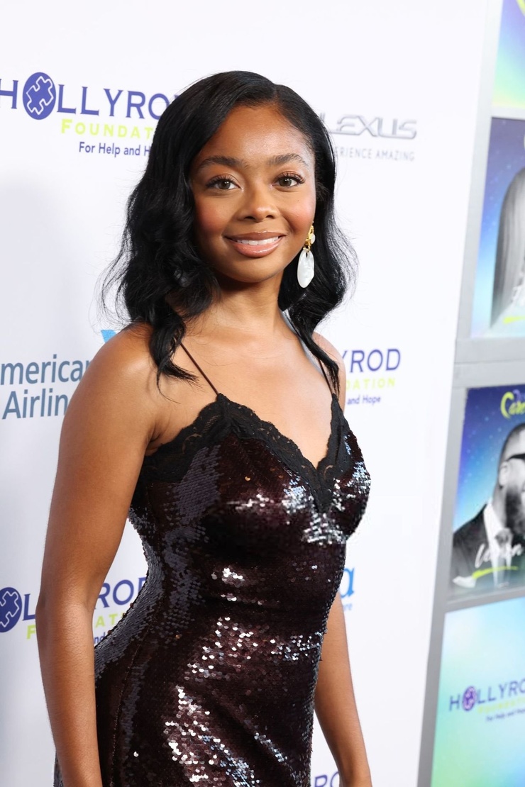 Com'è diventata Skai Jackson (Zuri di Jessie)? Il suo iglow up