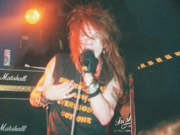 Axl Rose